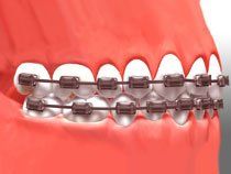 Orthodontics & Orthopedics